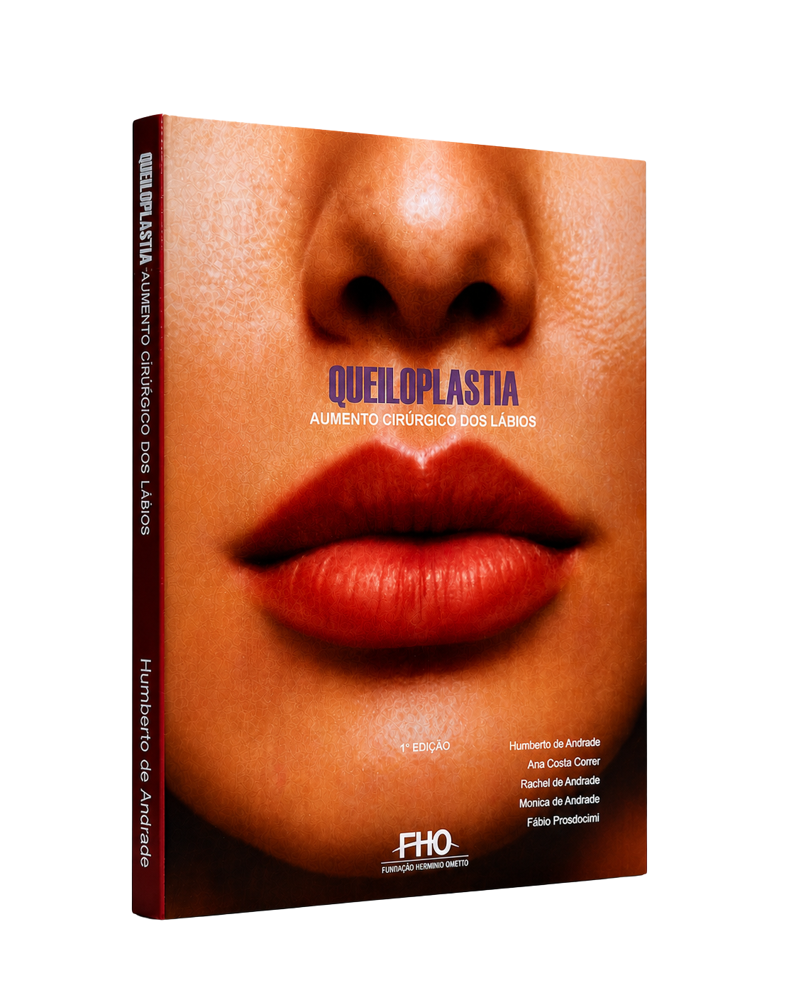 Capa do livro Queiloplastia: Aumento Cirúrgico dos Lábios